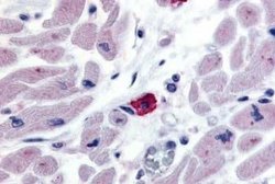 EMR3 Antibody, Novus Biologicals 50 &mu;g; Unconjugated:Antibodies, Polyclonal
